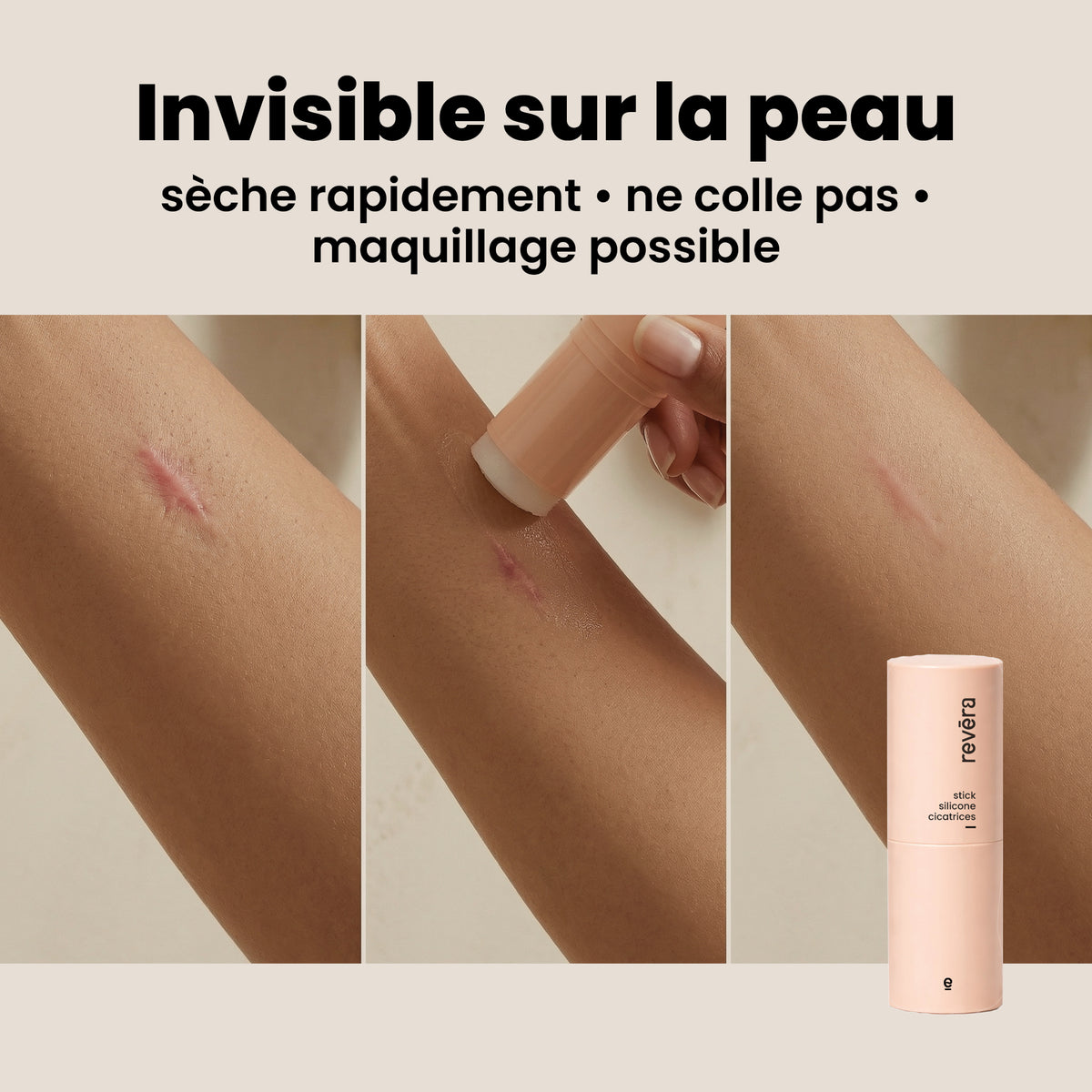 Revéra Soin - stick silicone cicatrices